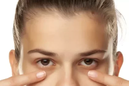 root-causes-of-under-eye-dark-circles (4)