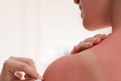 avoid-body-exfoliation (7)