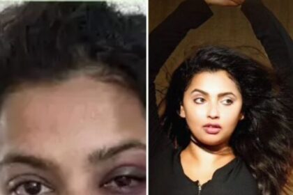 Anicka-vijayii-vikraman-brutally-beaten